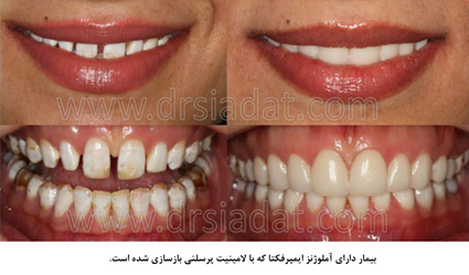 دندانپزشکی - بازسازی دهان و دندان